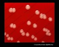 corynebacterium diphtheriae